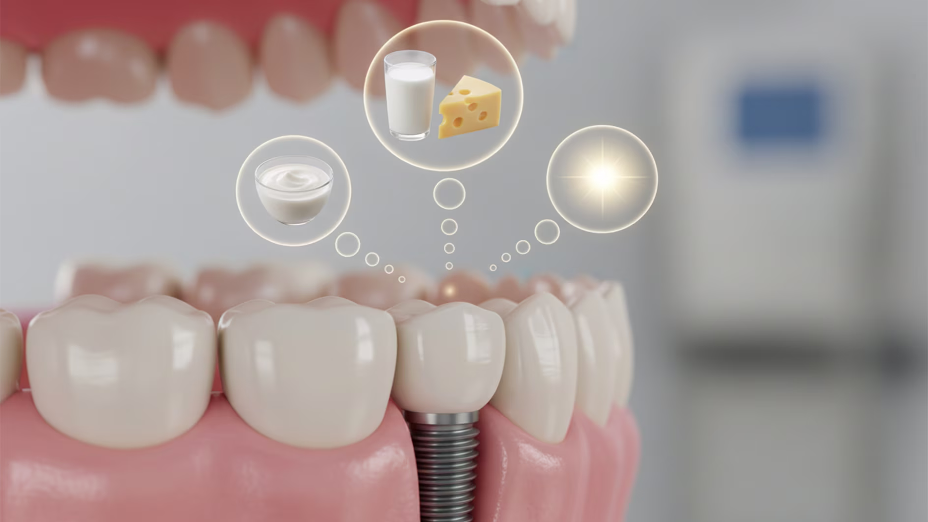 اهمیت ویتامین D و کلسیم در دوام ایمپلنت
